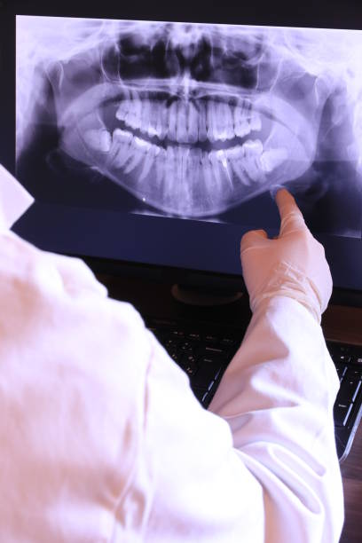 Best Emergency Tooth Extraction in Boyce, LA